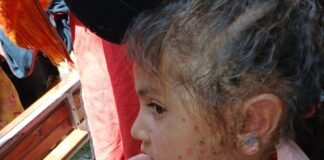 خیبرپښتونخوا کے سیلاب زدہ علاقوں میں بیماریاں پھیلنے کا خدشہ